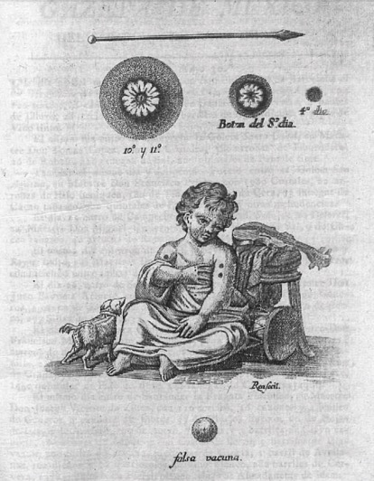 Engraving of a vaccinated child. 